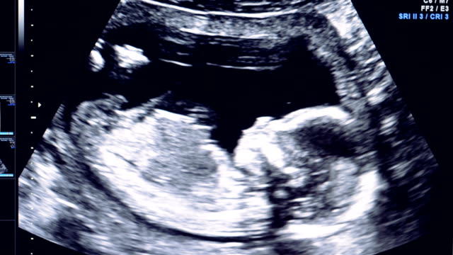 Discover everything you can do with a fake sonogram in 2022! post thumbnail image
